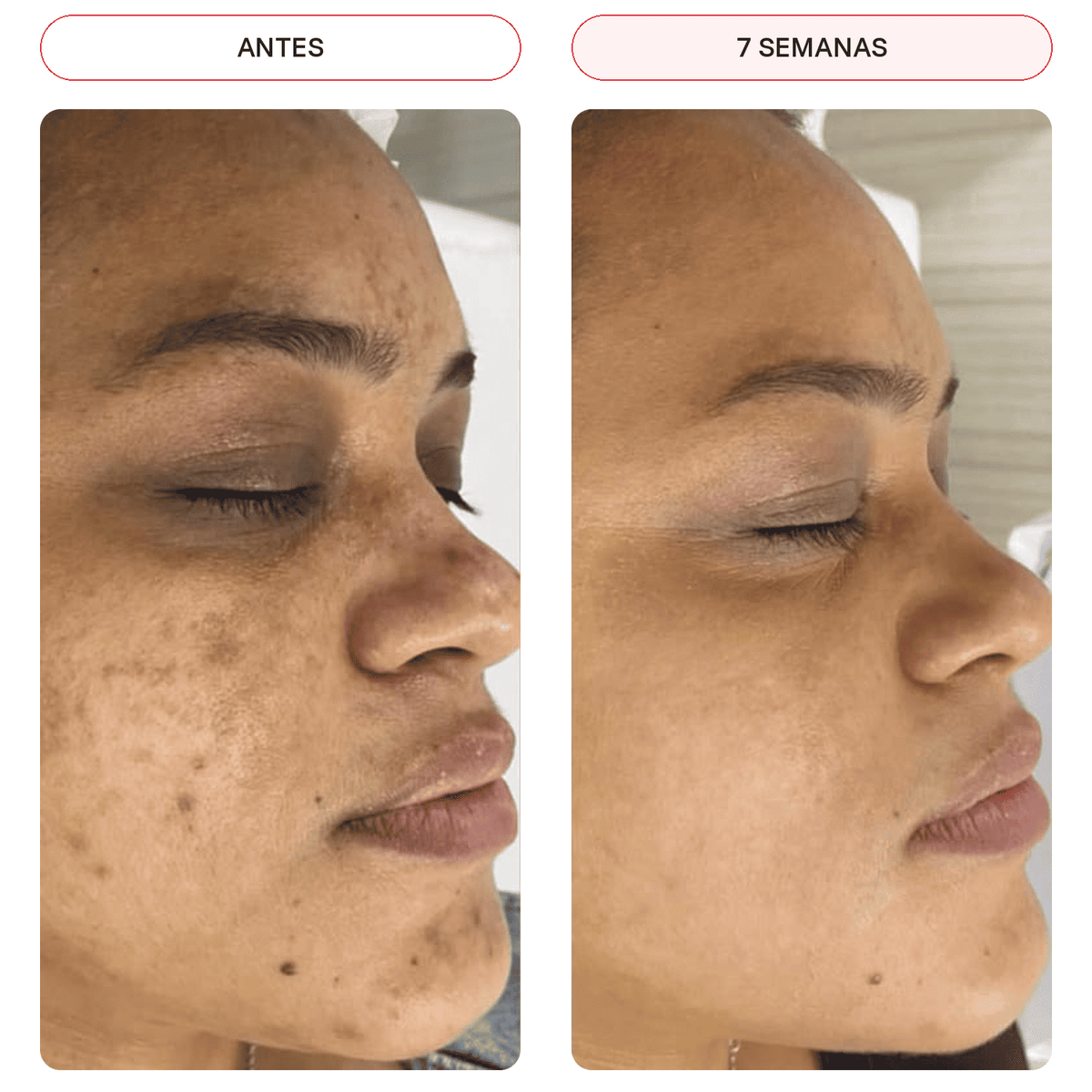 Crema Koreana Correctora